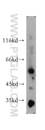 SMAP1 Antibody in Western Blot (WB)