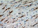 FABP4 Antibody in Immunohistochemistry (Paraffin) (IHC (P))