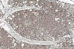 FABP4 Antibody in Immunohistochemistry (Paraffin) (IHC (P))