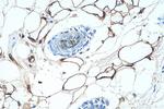 FABP4 Antibody in Immunohistochemistry (Paraffin) (IHC (P))