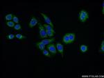 VPS26A Antibody in Immunocytochemistry (ICC/IF)