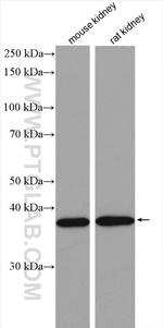 VPS26A Antibody in Western Blot (WB)