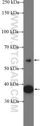 VPS26A Antibody in Western Blot (WB)