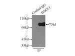 BACE1 Antibody in Immunoprecipitation (IP)