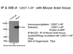 BACE1 Antibody in Immunoprecipitation (IP)