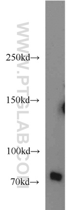 BACE1 Antibody in Western Blot (WB)