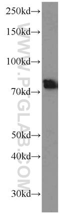 BACE1 Antibody in Western Blot (WB)