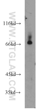 BACE1 Antibody in Western Blot (WB)