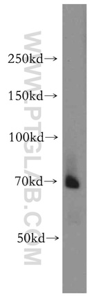 BACE1 Antibody in Western Blot (WB)