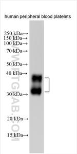 CLEC2/CLEC1B Antibody in Western Blot (WB)