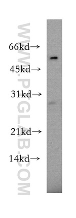 LRAT Antibody in Western Blot (WB)