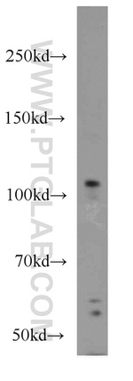 ITPKB Antibody in Western Blot (WB)