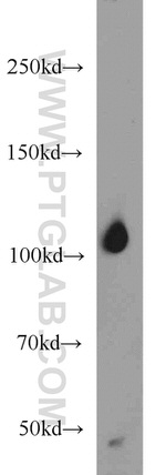 ITPKB Antibody in Western Blot (WB)