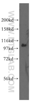 ITPKB Antibody in Western Blot (WB)