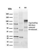 Collagen IV Antibody in SDS-PAGE (SDS-PAGE)