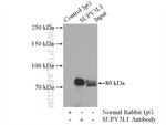SUPV3L1 Antibody in Immunoprecipitation (IP)