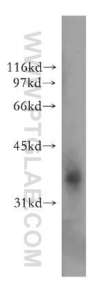EXTL2 Antibody in Western Blot (WB)
