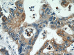 Alpha E catenin Antibody in Immunohistochemistry (Paraffin) (IHC (P))