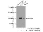 Alpha E catenin Antibody in Immunoprecipitation (IP)