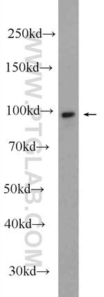 Alpha E catenin Antibody in Western Blot (WB)