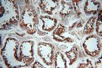 HDAC6 Antibody in Immunohistochemistry (Paraffin) (IHC (P))