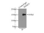 HDAC6 Antibody in Immunoprecipitation (IP)