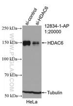 HDAC6 Antibody in Western Blot (WB)