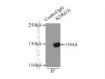 KDM3A/JMJD1A Antibody in Immunoprecipitation (IP)