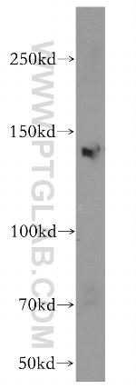 KDM3A/JMJD1A Antibody in Western Blot (WB)