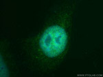 KDM3A/JMJD1A Antibody in Immunocytochemistry (ICC/IF)