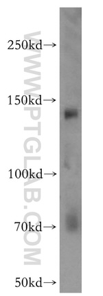 KDM3A/JMJD1A Antibody in Western Blot (WB)