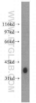 GYG1 Antibody in Western Blot (WB)