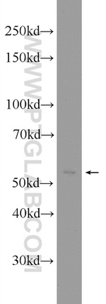 SMARCD3 Antibody in Western Blot (WB)