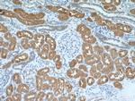 FBP1 Antibody in Immunohistochemistry (Paraffin) (IHC (P))