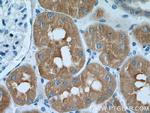 FBP1 Antibody in Immunohistochemistry (Paraffin) (IHC (P))