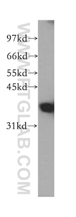 FBP1 Antibody in Western Blot (WB)