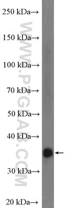 FBP1 Antibody in Western Blot (WB)