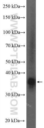 FBP1 Antibody in Western Blot (WB)