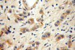 KGA/GAC Antibody in Immunohistochemistry (Paraffin) (IHC (P))