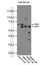 KGA/GAC Antibody in Western Blot (WB)