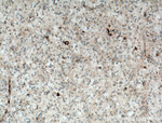 KGA/GAC Antibody in Immunohistochemistry (Paraffin) (IHC (P))