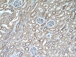 KGA/GAC Antibody in Immunohistochemistry (Paraffin) (IHC (P))