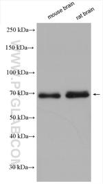 KGA/GAC Antibody in Western Blot (WB)