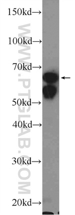 KGA/GAC Antibody in Western Blot (WB)