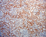 PHYH Antibody in Immunohistochemistry (Paraffin) (IHC (P))