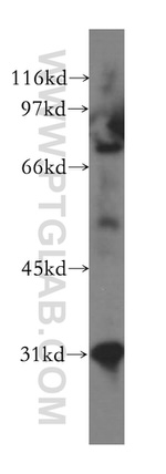 PHYH Antibody in Western Blot (WB)