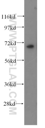 PHYH Antibody in Western Blot (WB)