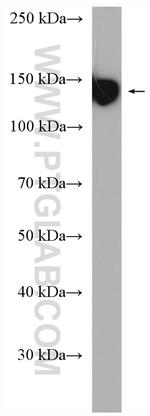 CD42b Antibody in Western Blot (WB)