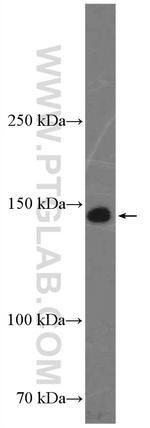 CD42b Antibody in Western Blot (WB)