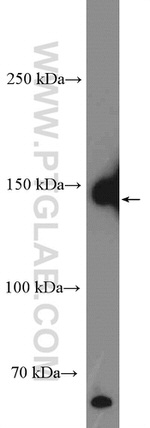 CD42b Antibody in Western Blot (WB)